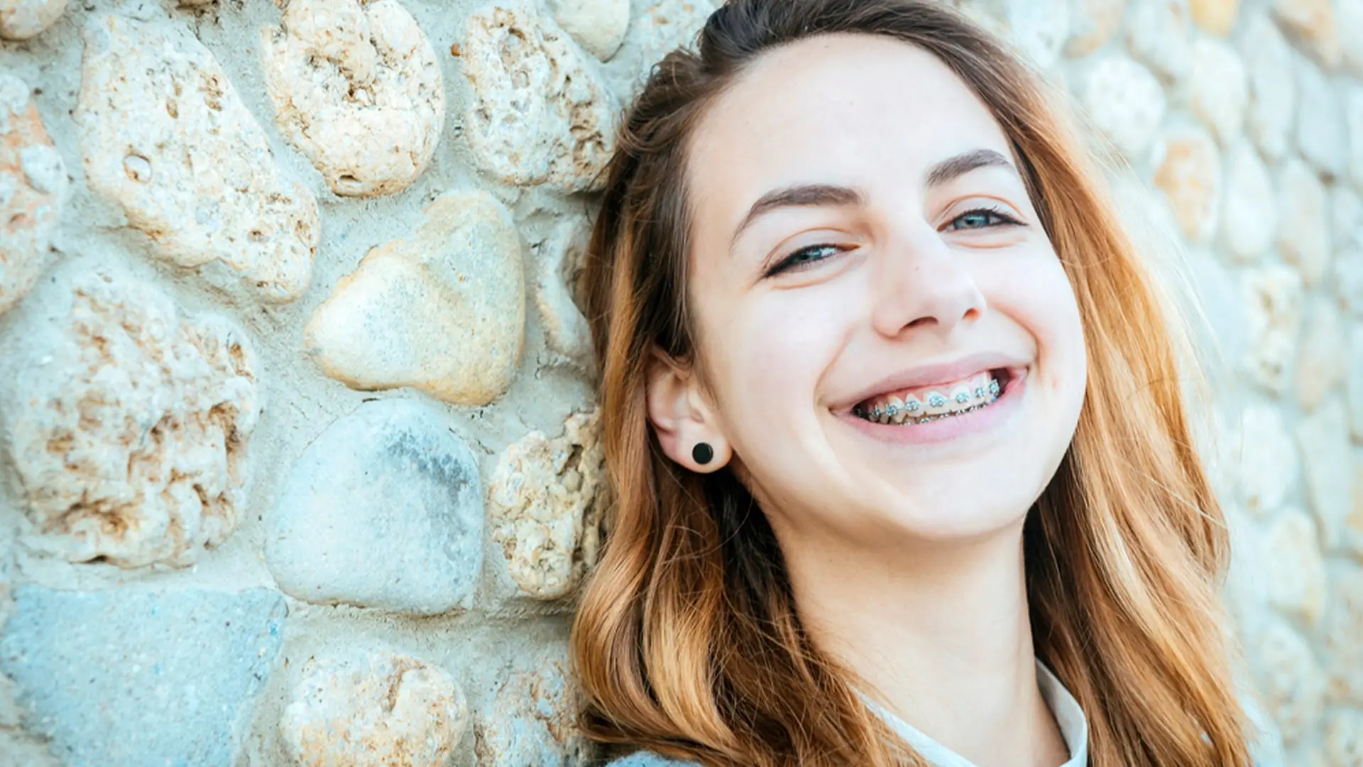 ¿Cuál es la edad ideal para la ortodoncia infantil?